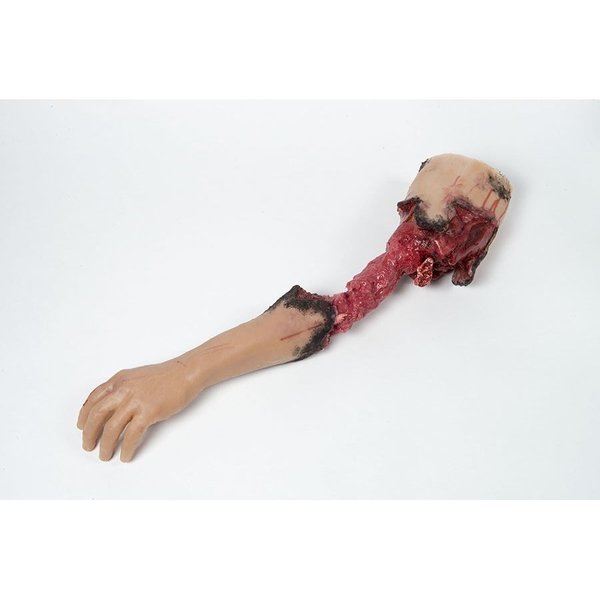 Moulage Science & Training Partial Arm Amputation, Right, Medium MST-31-03-R01